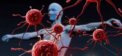 المؤتمر نت - من هم الأكثر عرضة للإصابة بالسرطان؟